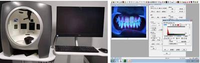 Digital imaging and qPCR analysis and comparison of short-term plaque removal effects of tooth brushing